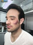 Charlie Cox 2025_1